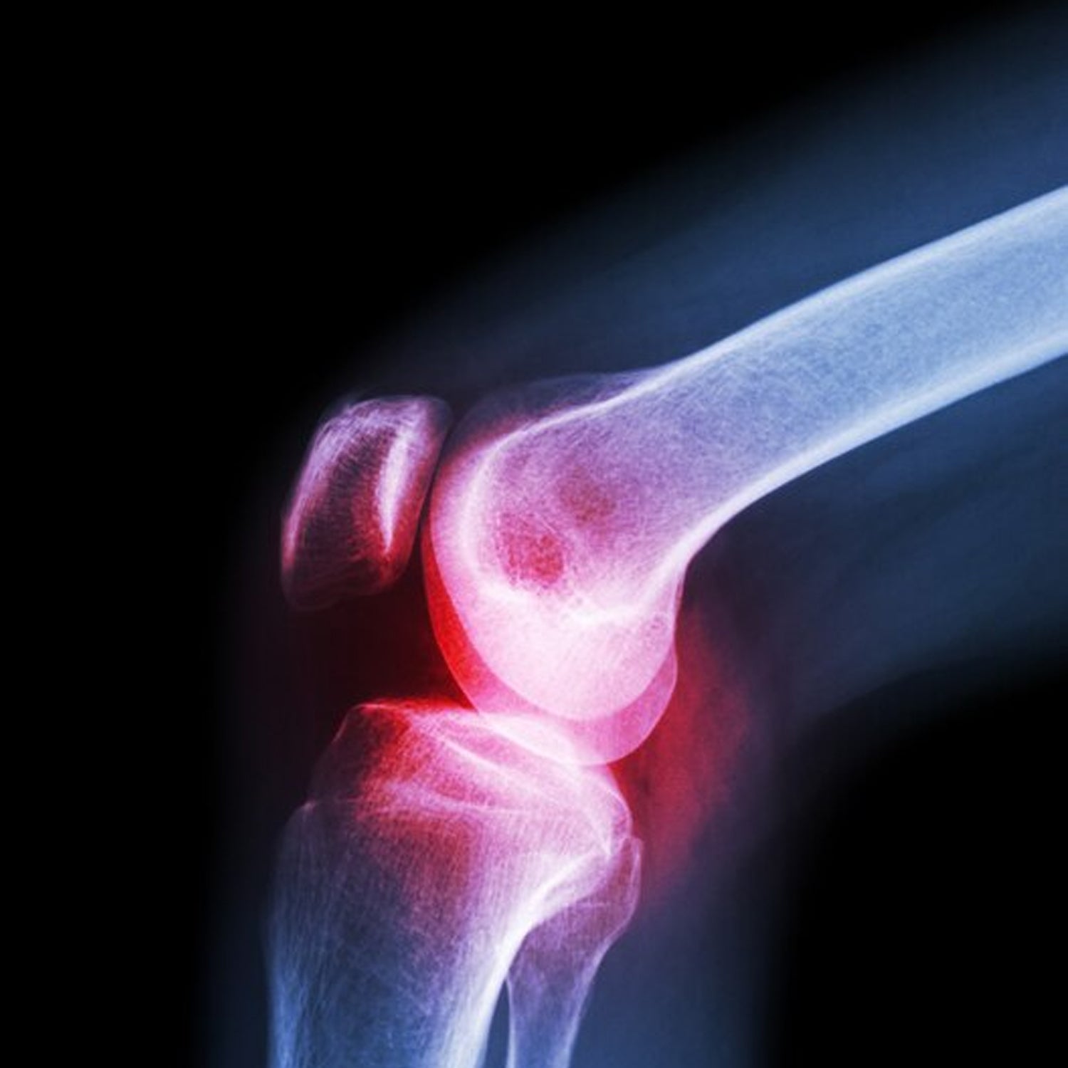 breathable knit knee cap xl size pack of 1