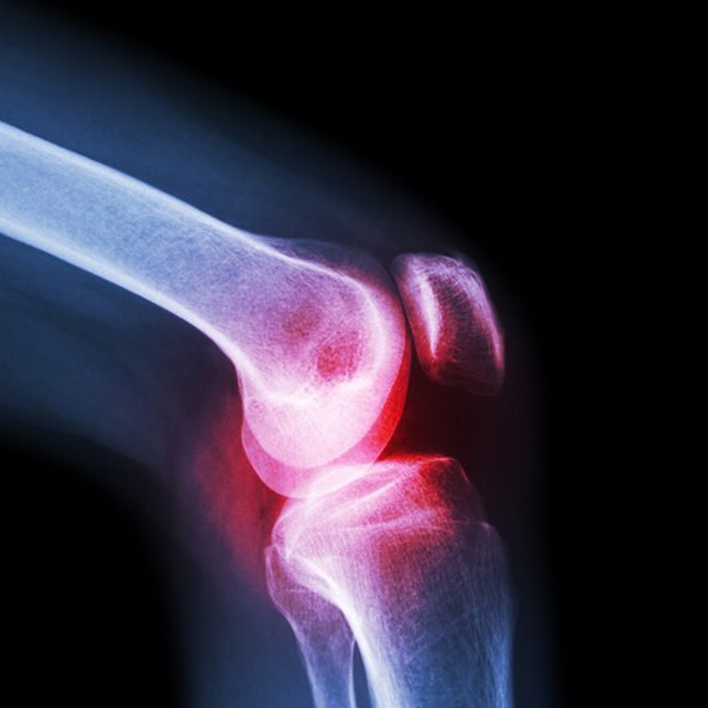 breathable knit large knee cap for knee support pack of 1