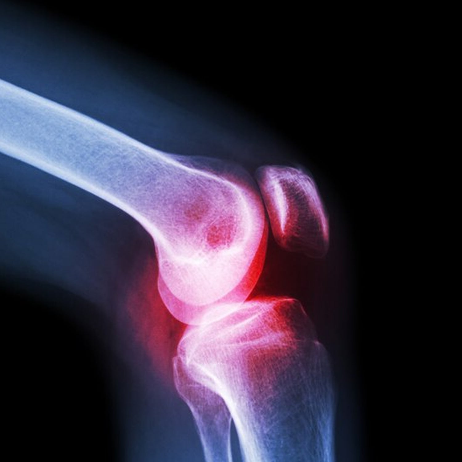 breathable knit large knee cap for knee support pack of 1