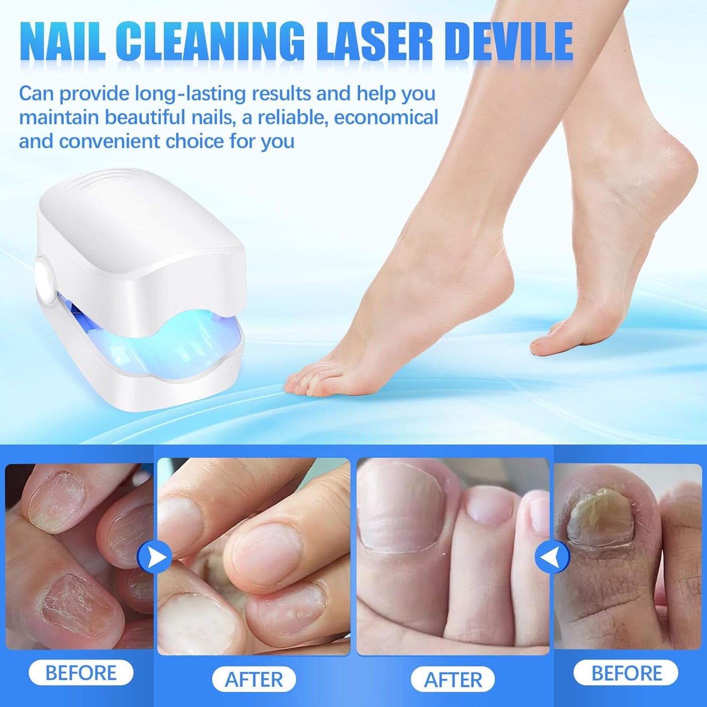 durable plastic rechargeable nail fungus treatment device 66g pack of 1